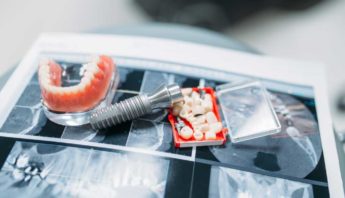Prótesis dental Blanco Ramos